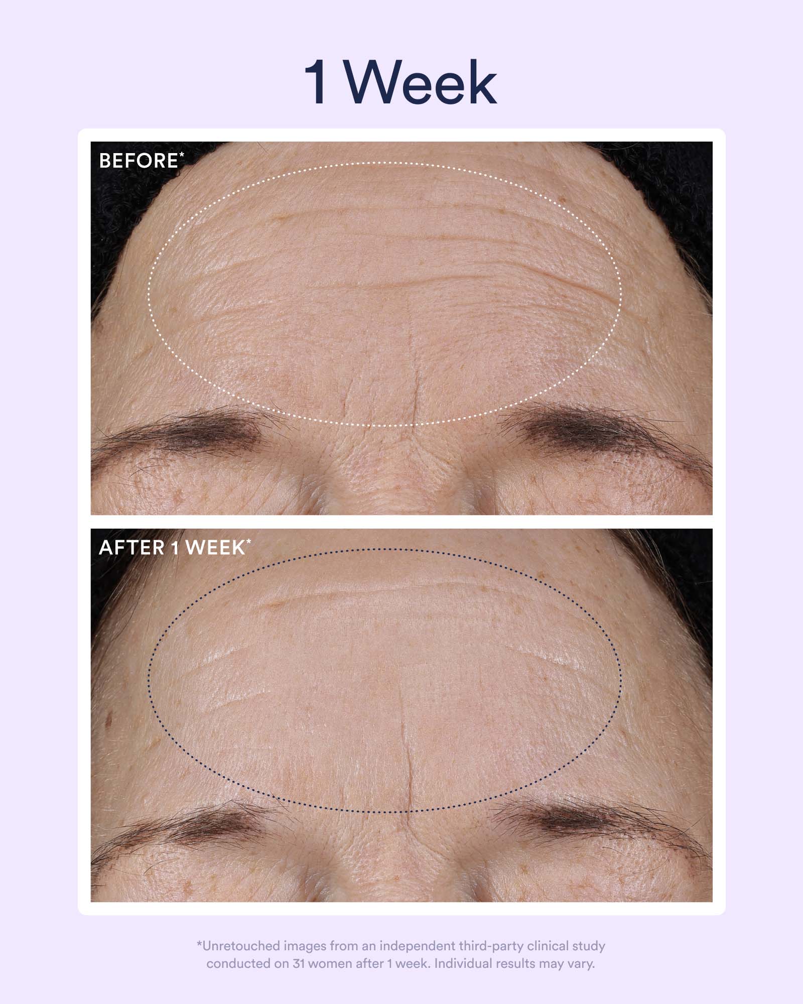 Dream Night Serum with Bio-Retinol - Image 4